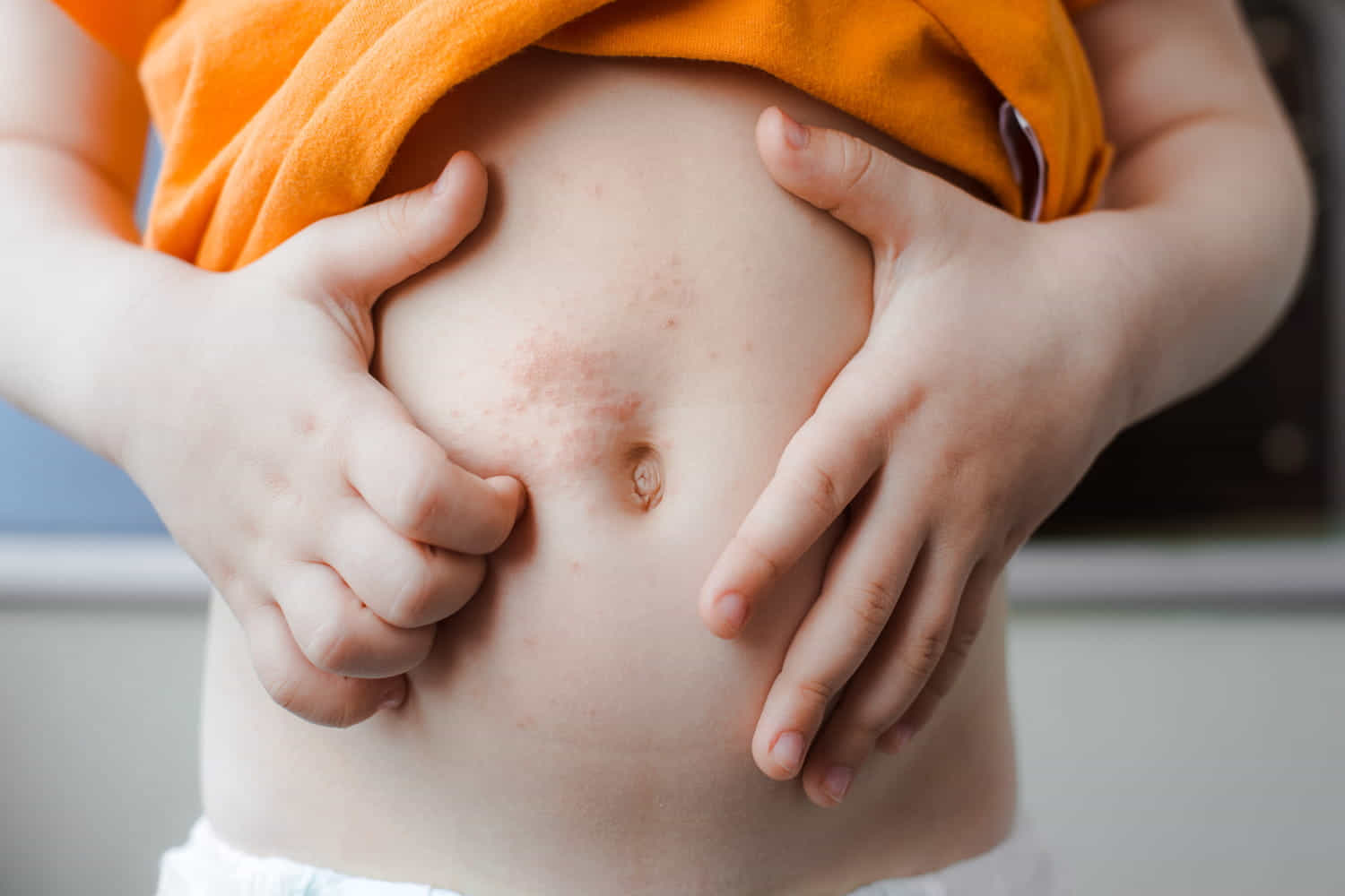 scabbia nei bambini e negli anziani